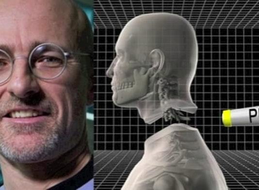 इटली के डॉक्टर्स ने किया कमाल, 18 घंटे की सर्जरी में बदल दिया मानव सिर