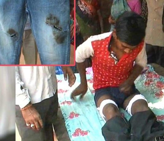 छात्र पहनकर आया जींस, गुस्साए स्कूल प्रशासन ने काट डाली टांग