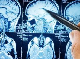 वैज्ञानिकों ने खोजा ब्लड टेस्ट से कैंसर पता करने का तरीका