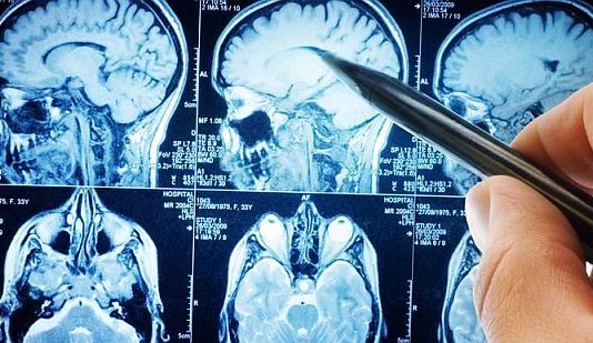 वैज्ञानिकों ने खोजा ब्लड टेस्ट से कैंसर पता करने का तरीका