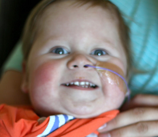 शरीर के बाहर था बच्ची का दिल, लेकिन अब मनाने जा रही है, अपना तीसरा बर्थ डे