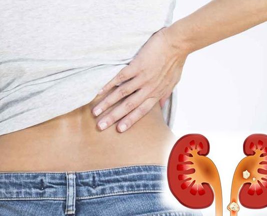 पथरी के लिए रामबाण साबित हो सकते हैं ये आयुर्वेदिक उपाय