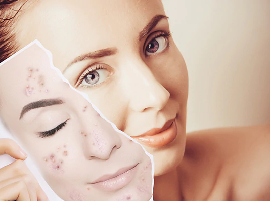 चंदन का तेल बालों और त्वचा की खूबसूरती के लिए फायदेमंद, जानें इस्तेमाल करने का तरीका