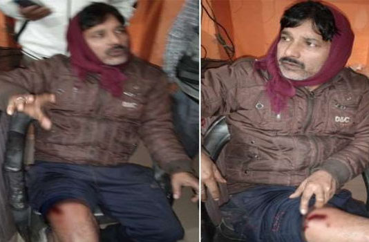 लखनऊ: परचून दुकानदार को गोली मारकर बदमाशों ने लूट ली स्कूटी-कैश, जांच में जुटी पुलिस