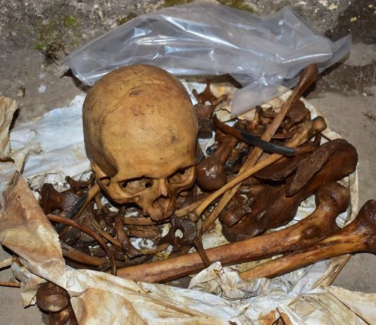 सुलभ शौचालय की टंकी में मिला नर कंकाल