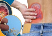 क्या आप भी लेते हैं विटामिन C की गोली? हो जाइये सावधान!