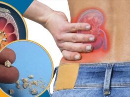 क्या आप भी लेते हैं विटामिन C की गोली? हो जाइये सावधान!