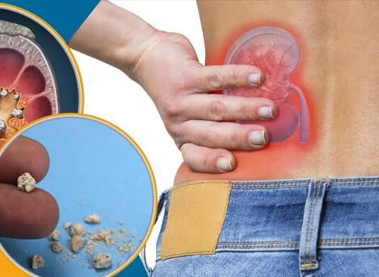 क्या आप भी लेते हैं विटामिन C की गोली? हो जाइये सावधान!