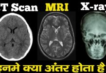आखिर क्या है X-RAY,MRI और CT SCAN के बीच अंतर?