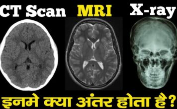 आखिर क्या है X-RAY,MRI और CT SCAN के बीच अंतर?